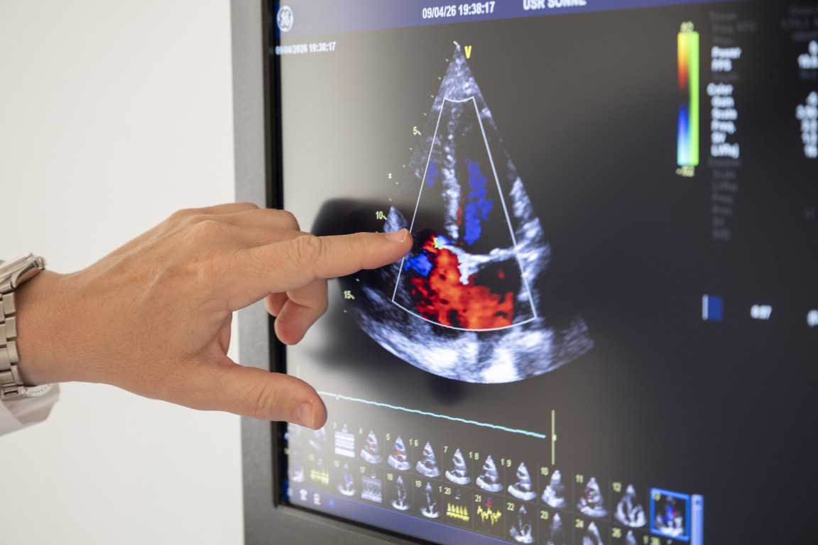 Diagnostic Evaluation and Cardiovascular Imaging